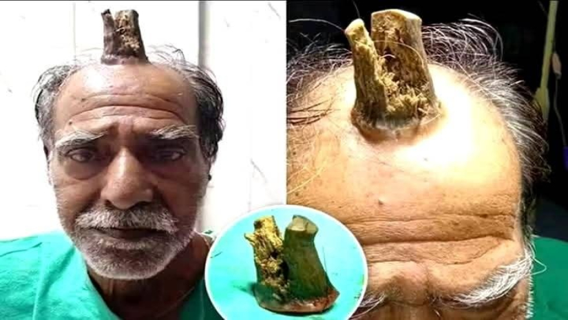 শয়তানের শিং নিয়ে ৭৪ বছর পার!